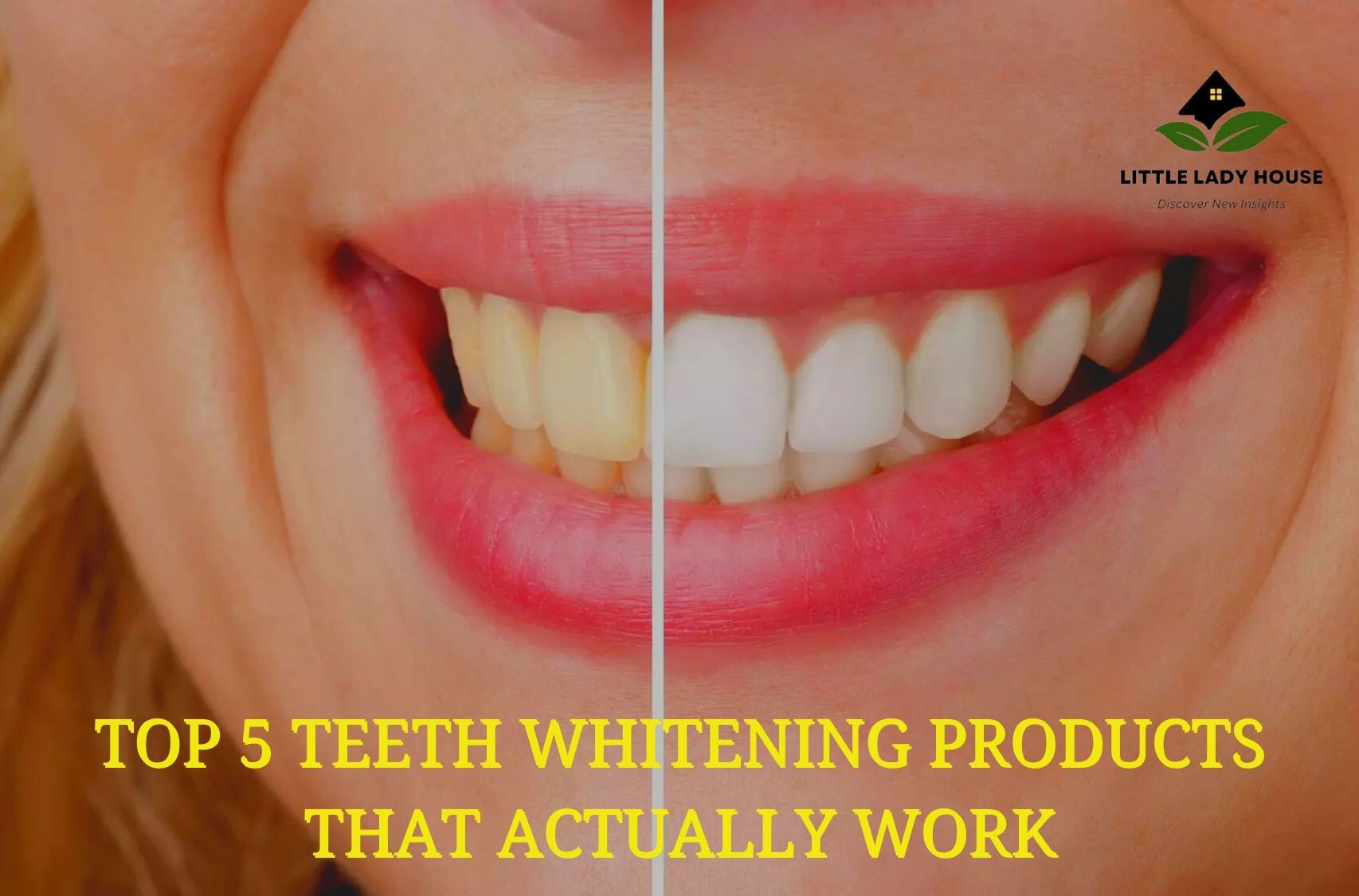 TOP 5 TEETH WHITENING PRODUCTS THAT ACTUALLY WORK