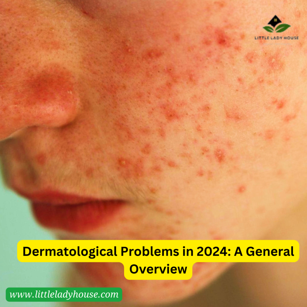 Dermatological Problems in 2024: A General Overview